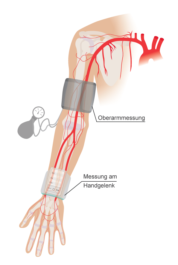Messung des Blutdrucks am Oberarm und Handgelenk